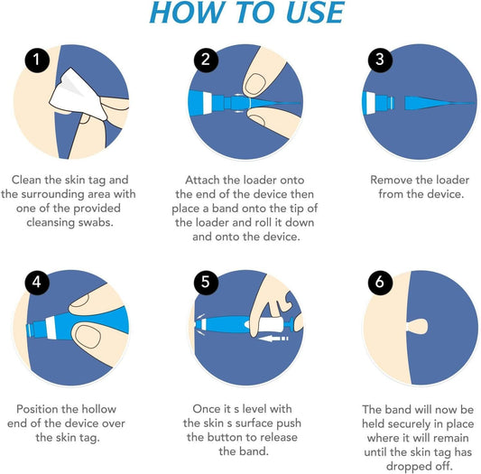 2 in 1 Skin Tag Remover Kit - Painless www.trikaro.com